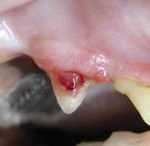 cat tooth